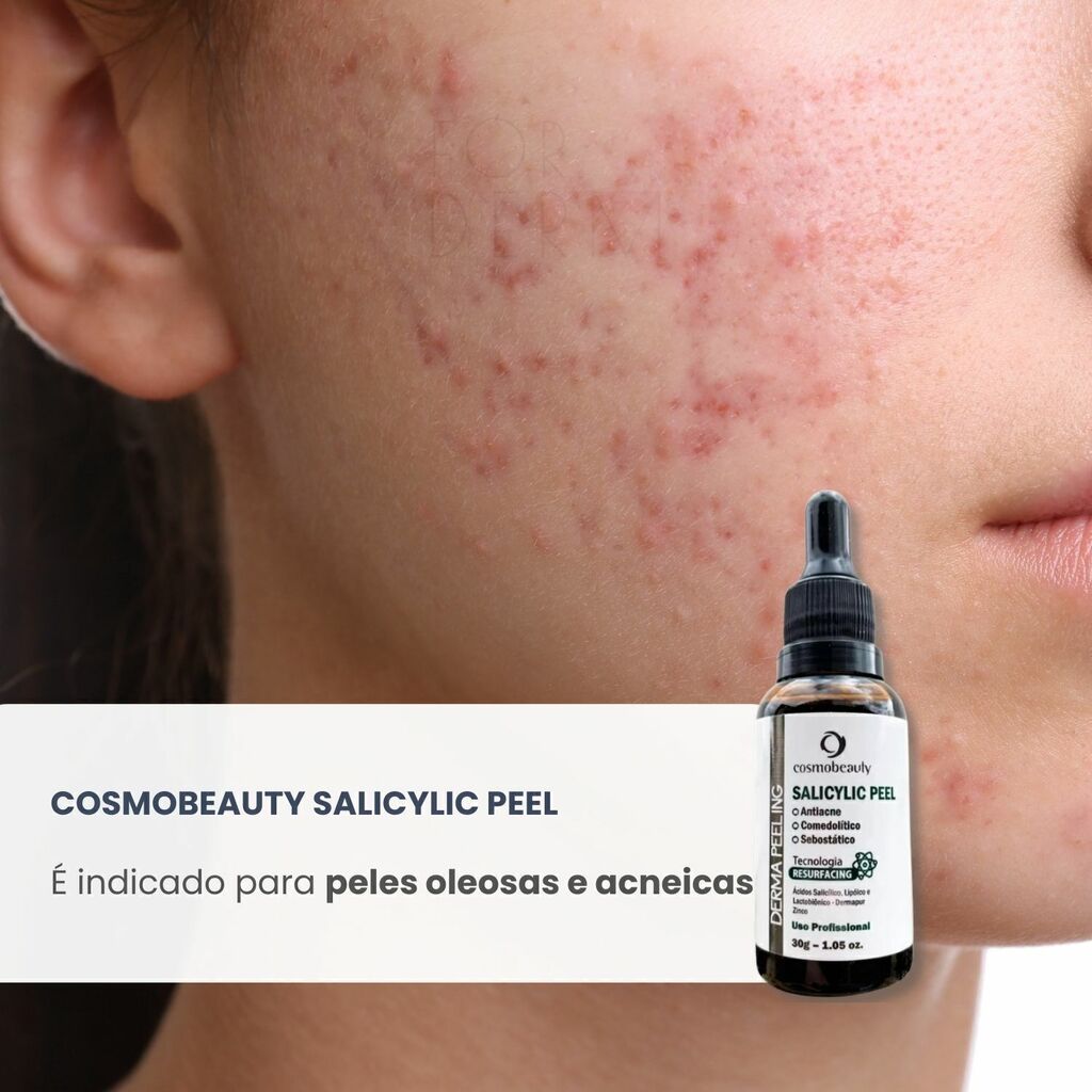 Cosmobeauty Derma Peeling Salicylic Anti Acne 30g